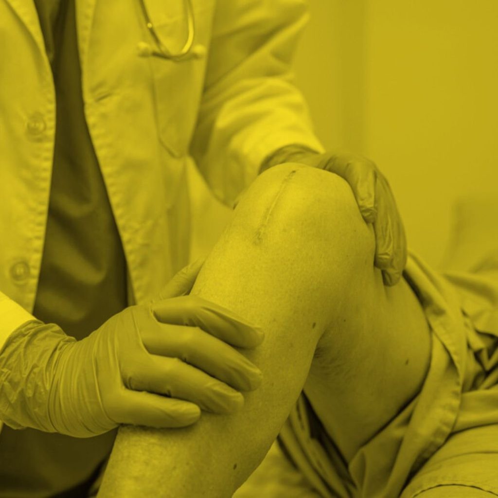 Essential Steps to Take Before Your Total Knee Replacement Surgery