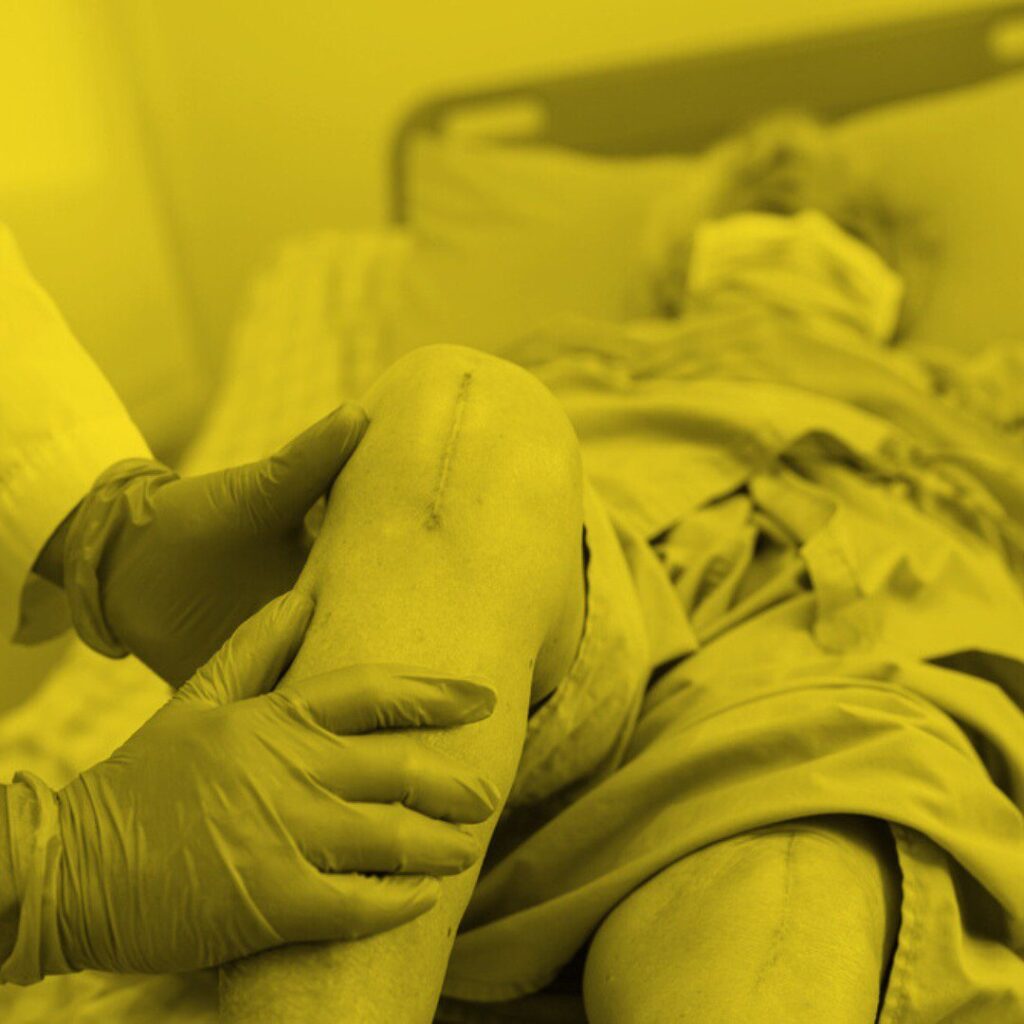 5 Common Mistakes in Knee Replacement Recovery and How to Avoid Them