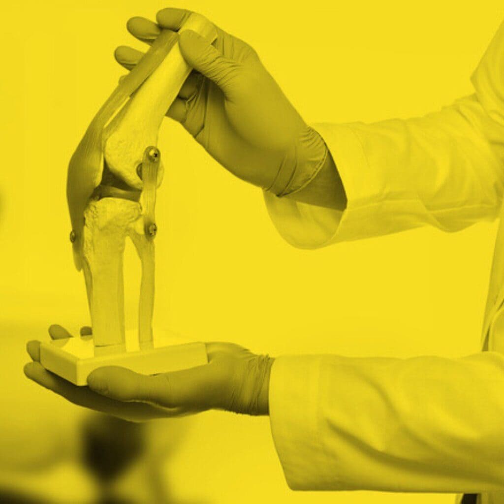 Are You at Risk for Osteoarthritis? How Lifestyle Choices Impact Knee Health