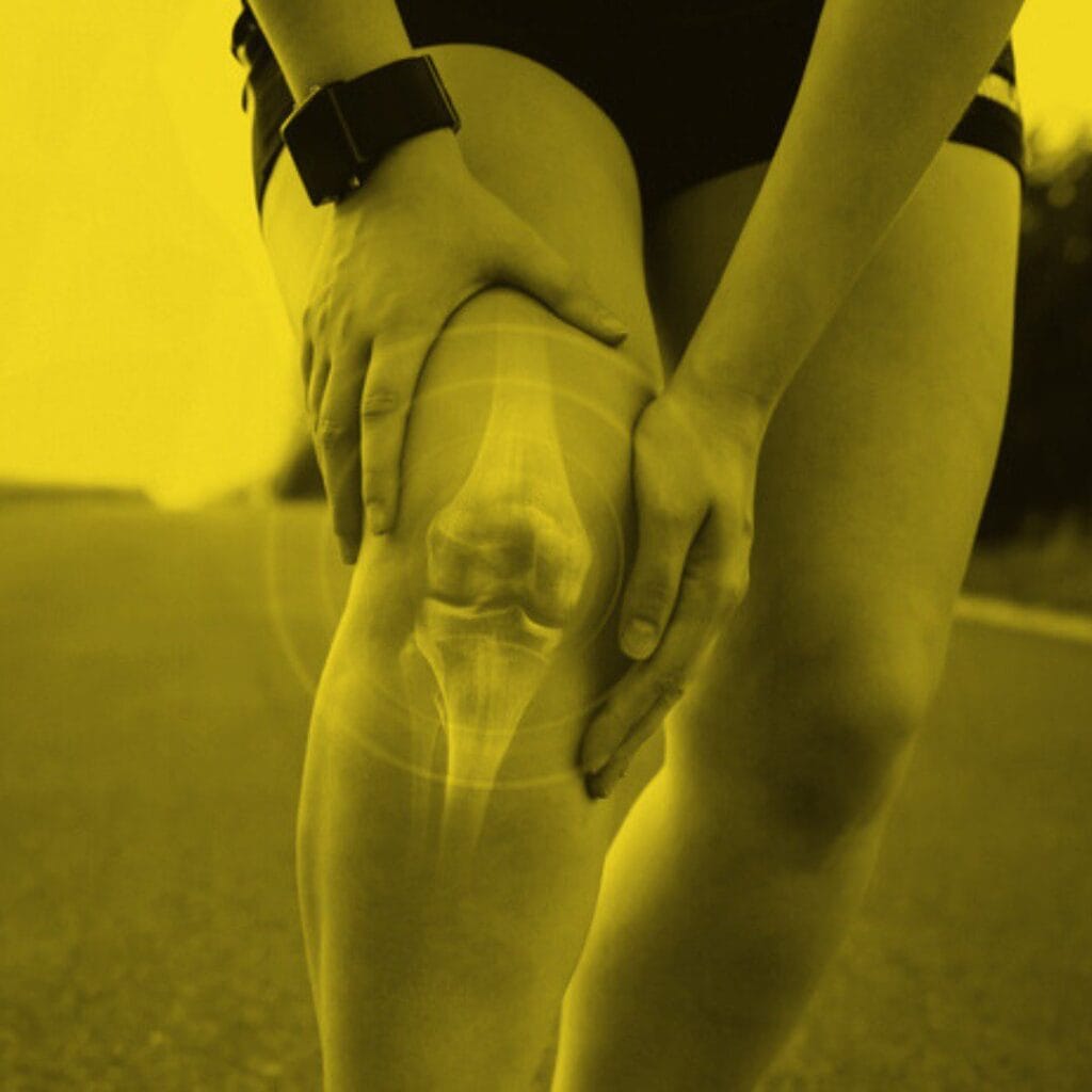 Knee Popping: Just a Quirk or a Sign of Something More Serious?