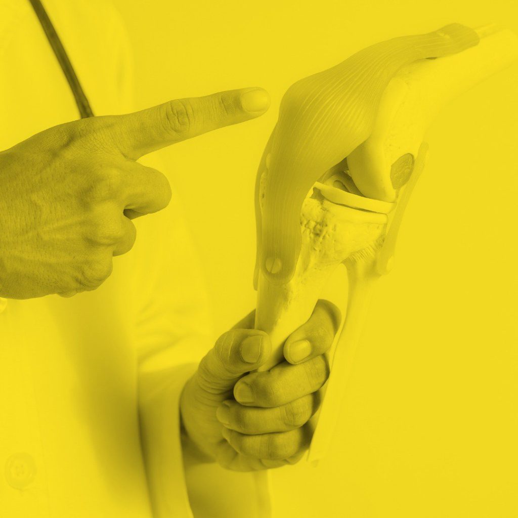 Neglecting Bone Health? Here’s How It Can Impact Your Knees