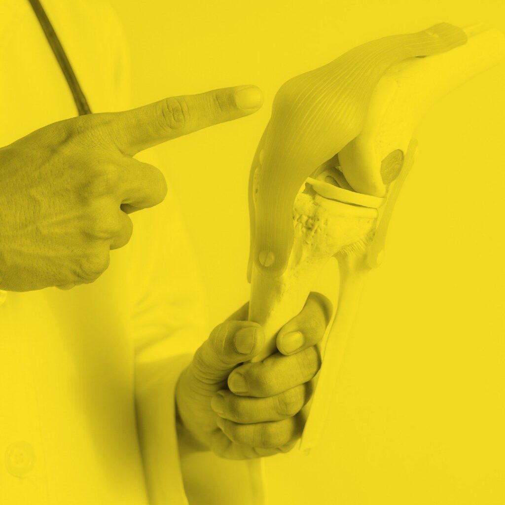 Neglecting Bone Health? Here’s How It Can Impact Your Knees