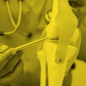 Genicular Artery Embolization: Receive Pain Relief Without Surgery cover