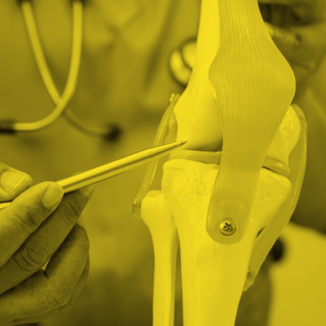Genicular Artery Embolization: Receive Pain Relief Without Surgery cover