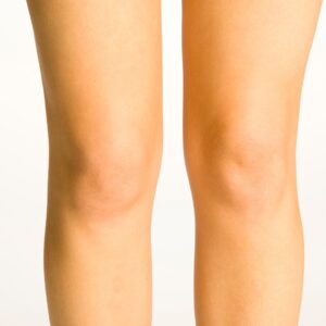 Why Full Knee Extension Matters for Successful Knee Rehab cover