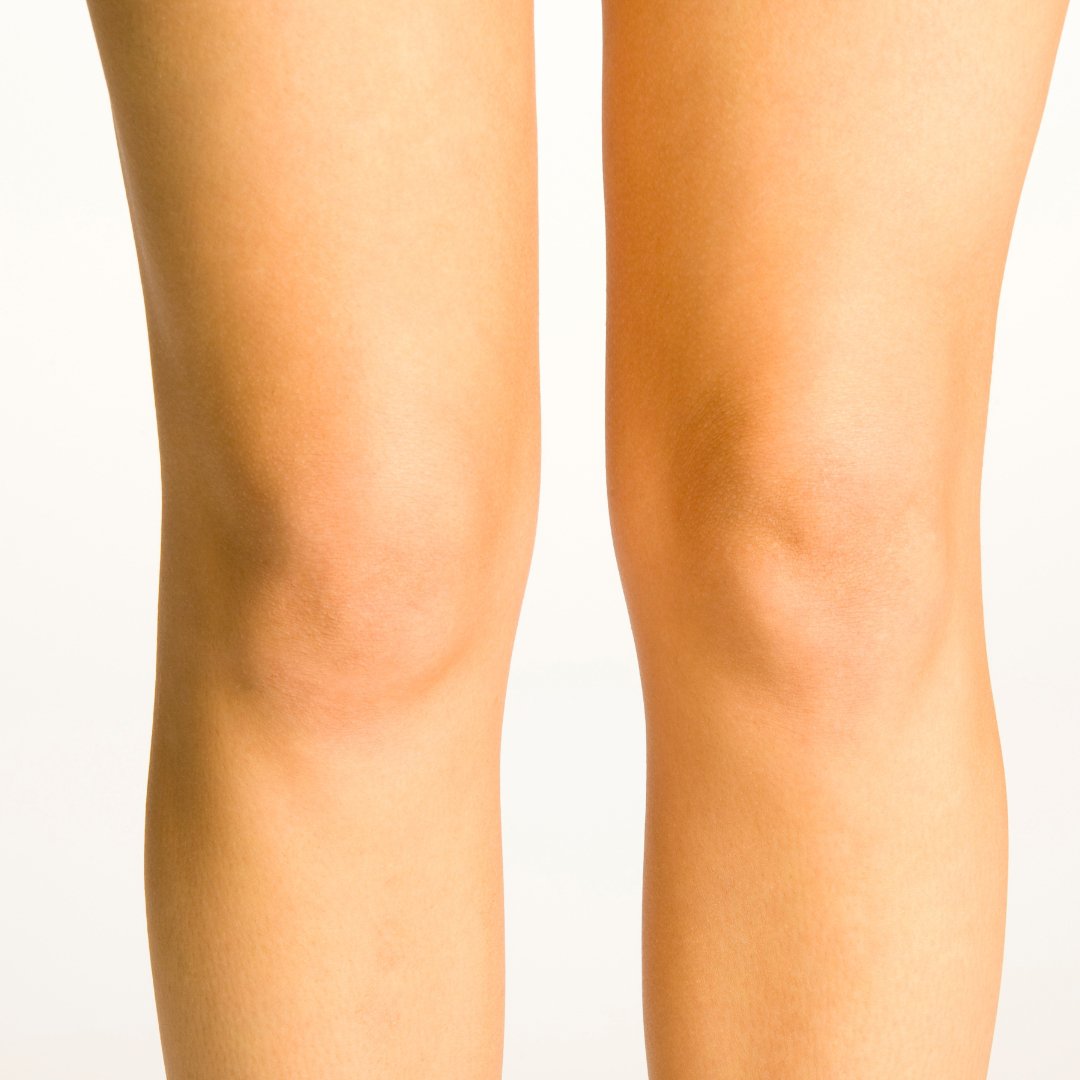 Why Full Knee Extension Matters for Successful Knee Rehab cover