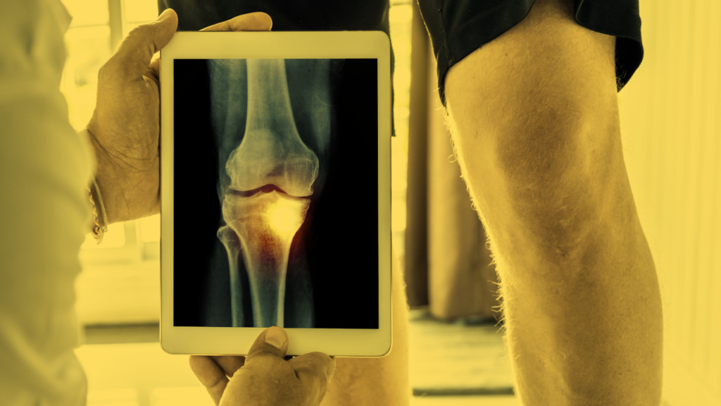 Download the Ultimate Pre-Surgery Checklist - Everything to Prepare You For Knee Replacement Surgery