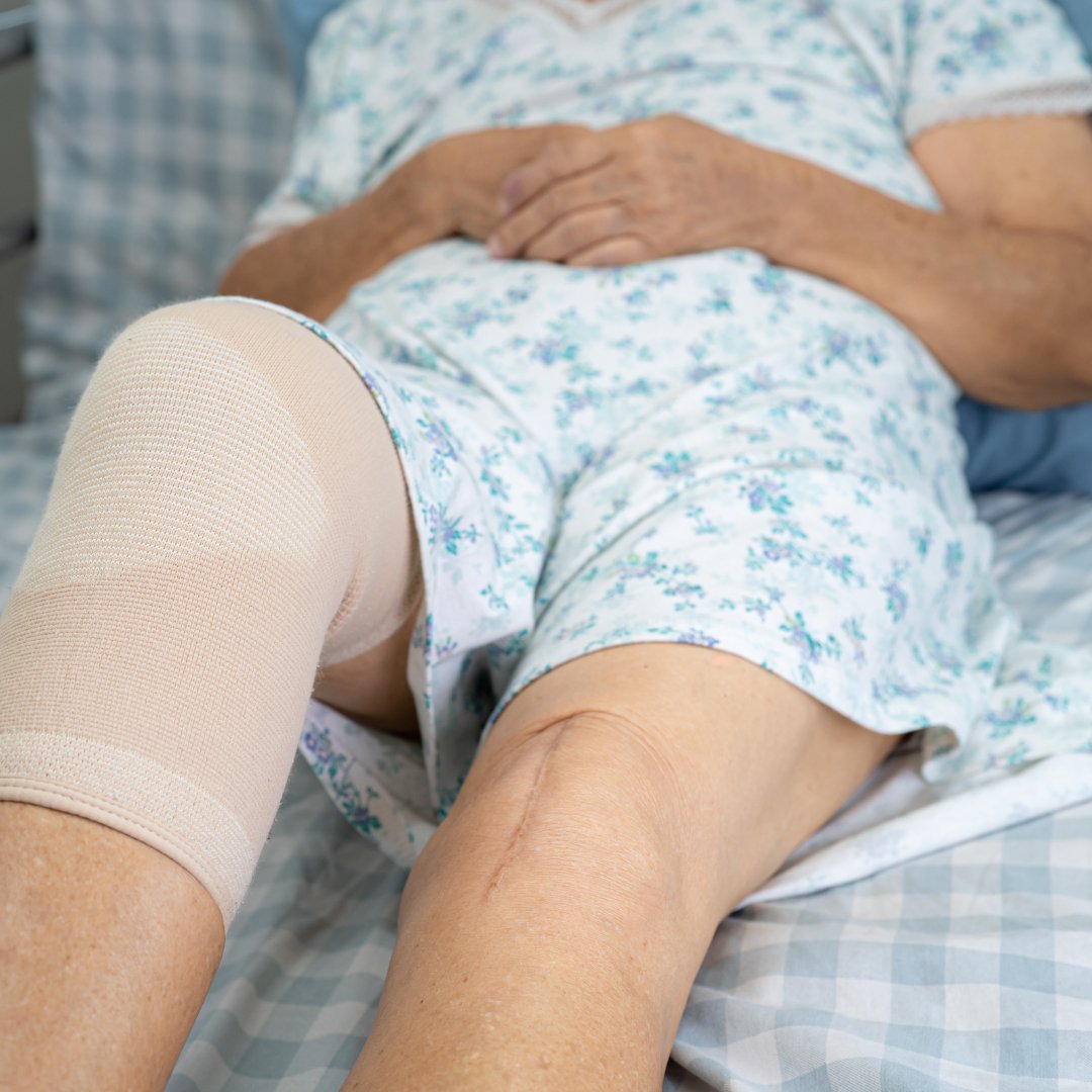 How Much Does Knee Replacement Surgery Cost? cover