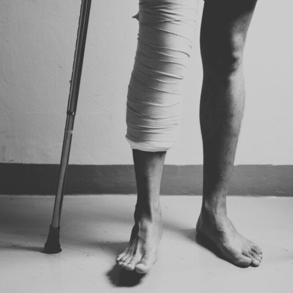 Are There Permanent Restrictions After Knee Replacement Surgery?