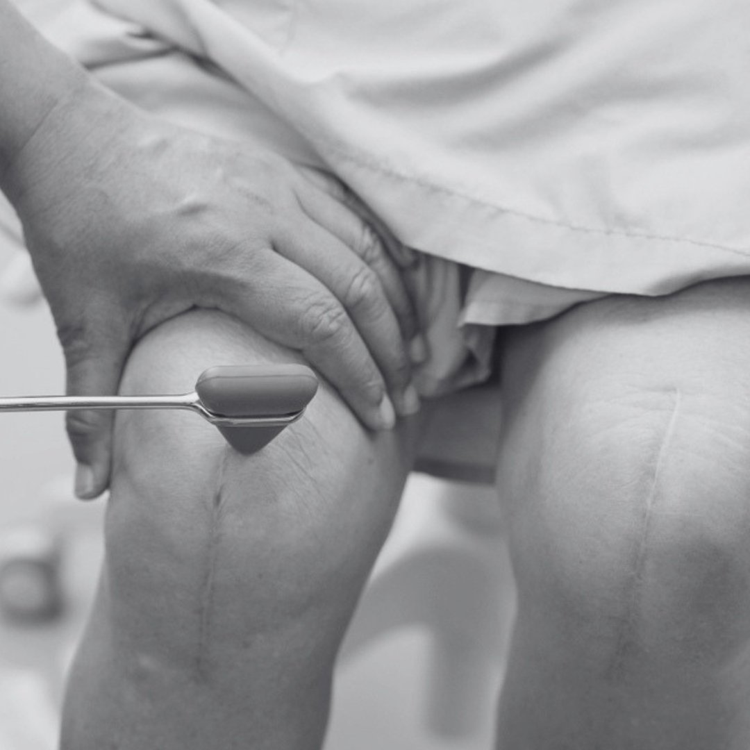 Knee replacement surgery recovery